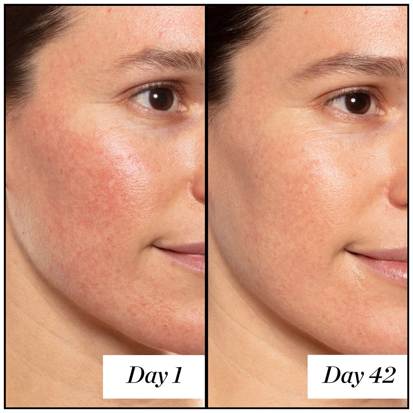 Sunday Riley A+ High-Dose Retinoid Serum 50ml - Image 4
