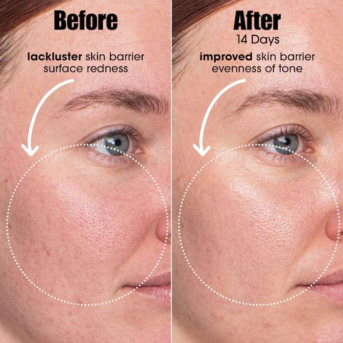 Sunday Riley A.I. Adaptive Retinoid Serum For Blemish Prone Skin - Image 2