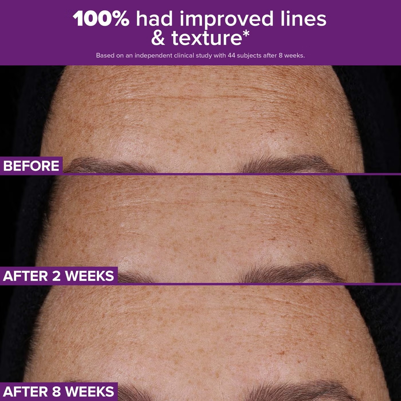 Paula's Choice Clinical Pro Retinaldehyde Dual-Retinoid Treatment 30ml - Image 3