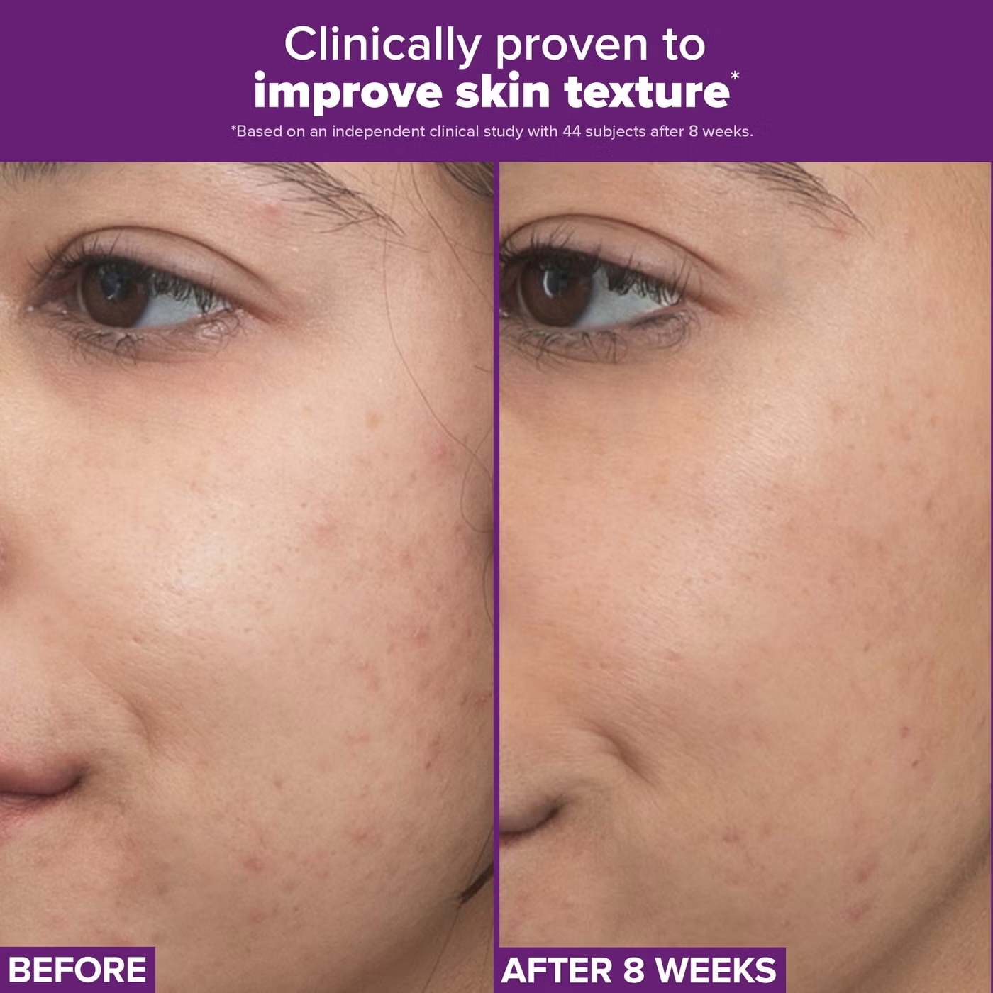 Paula's Choice Clinical Pro Retinaldehyde Dual-Retinoid Treatment 30ml - Image 4